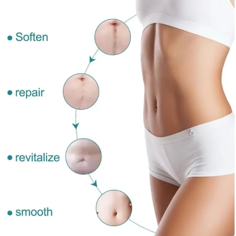 Silicone Scar Removal Strips